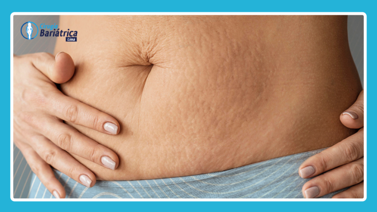 aceite de coco para el cuerpo y adelgazar y desaprecer estrias