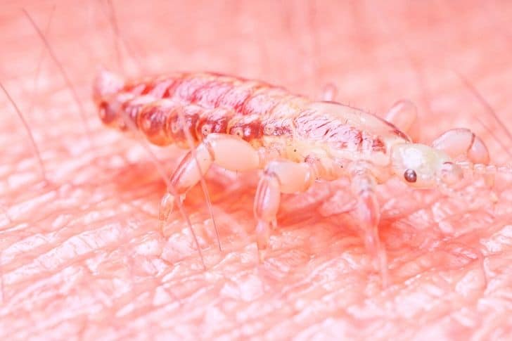 aceite de coco para los piojos